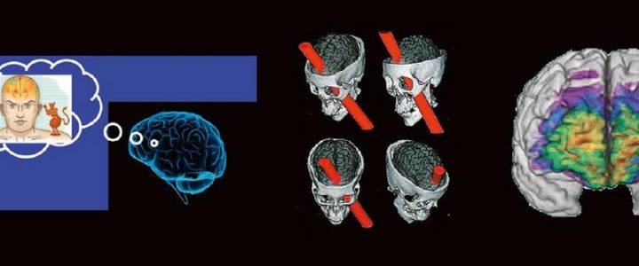 Outside the box-Vortrag: die Neuroradiologie der Moral (Webinar | Online)