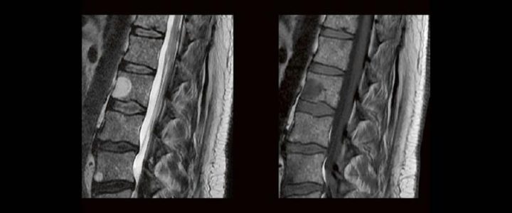 Blickdiagnosen im MRT für MTR (Webinar | Online)